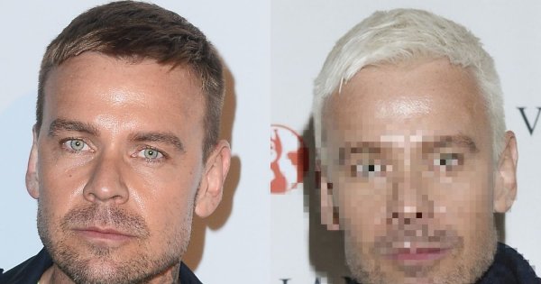 Dawid Woliński przefarbował włosy na SIWO! Ale to nie wszystko. Wygląda jak... OBCY?