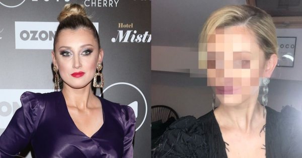 Justyna Żyła pierwszy raz po POWIĘKSZENIU UST! Wow, co za metamorfoza! Szok!