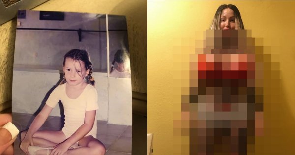 Ta śliczna dziewczynka zmieniła się w potwora. Zapłaciła za operacje plastyczne 400 tysięcy. Prawie umarła przez operację waginy!