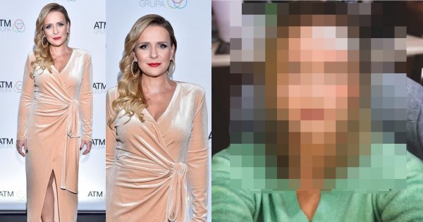 Posiniaczona Aneta Zając opublikowała drastyczne zdjęcia. Co się stało? Jak do tego doszło? Wyznała prawdę!