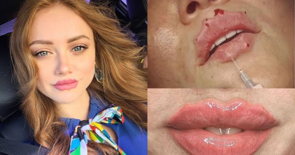 Octopus lips coraz bardziej zdobywają sieć! Najnowsze zdjęcia PRZERAŻAJĄ