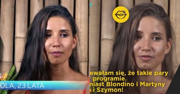 Ola z "Hotel Paradise" powiększyła usta! Naturalna dziewczyna oszpeciła się?