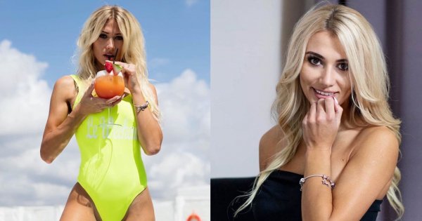 Beata Grucela z "Love Island" miała wypadek! Pokazała wstrząsające obrażenia twarzy. "Wyglądam jak Frankenstein"