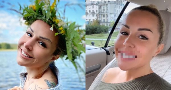 Blanka Lipińska założyła aparat na zęby! Zobaczcie, jak w nim wygląda!