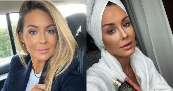 Małgorzata Rozenek zdradza "sekret" swojego idealnego wyglądu. A fanki:"Takie kity się ludziom wciska, że głowa mała" - nie wierzą w jej uczciwość?