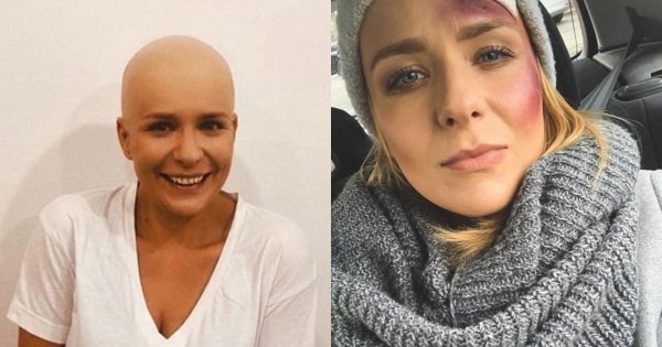 Aneta Zając cała we krwi: "Myślałam, że to na Halloween" - pisze fanka. Nic z tych rzeczy!