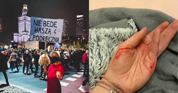 Julia Wróblewska relacjonuje wczorajszy strajk: "Zostałam popchnięta, uderzona, dostałam w ramiona, biodra i nerki"
