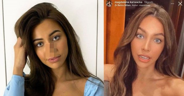 Magdalena Karwacka z "Love Island" miała operację nosa! Jak wyglądała przed operacją?