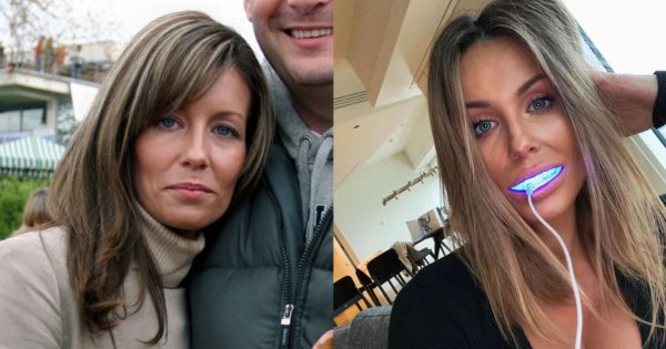Małgorzata Rozenek da 100.000 zł, jak udowodnisz, że ma licówki! Przypominamy jej stare zdjęcia