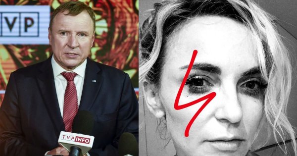 Anna Wyszkoni odpowiada na atak w materiale TVP: Jest tak absurdalny, że brakuje słów