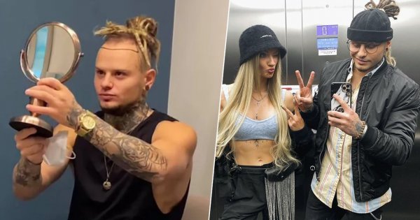 Mateusz z Fit Lovers w końcu pokazał przeszczepione włosy. Zaszalał z fryzurą!
