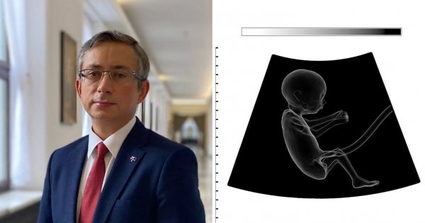 Poseł chciał 500 plus za okres, gdy córka była "dzieckiem poczętym". Jest odpowiedź urzędu
