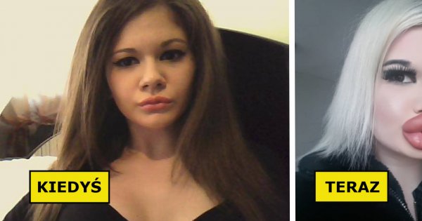 Andrea Ivanova jest posiadaczką największych ust na świecie! "Żywa Barbie" powiększała je aż 22 razy!