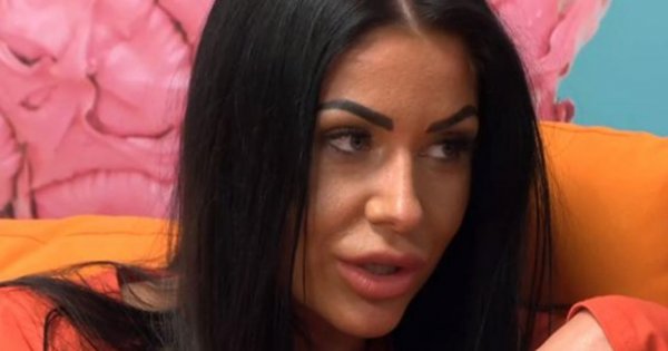 "Love Island": Do sieci wyciekło dawne zdjęcie Stelli. Przed operacjami była nie do poznania!