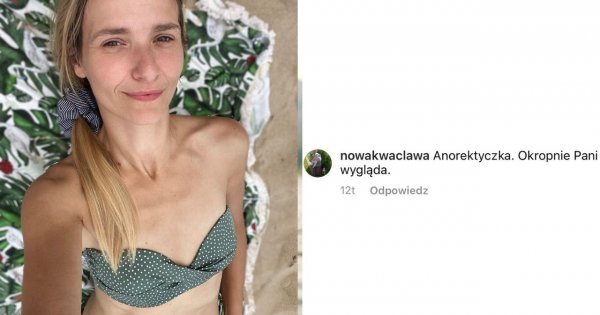 Joanna Koroniewska szczerze o zaburzeniach odżywiania: "Warto zmierzyć się z tym problemem a nie z tego żartować."