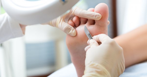 Pedicure leczniczy i frezarkowy: czas trwania, cena, przeciwwskazania