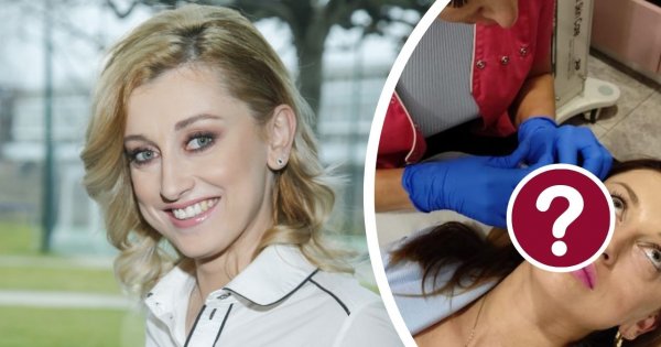 Justyna Żyła ostrzykuje twarz. To jej sposób na pozbycie się zmęczonego wyglądu