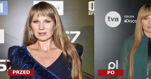 Anna Guzik i jej fryzura na ramówce TVN. Fani podzieleni "Dwa leżące ogonki" vs "piękne naturalne włosy"