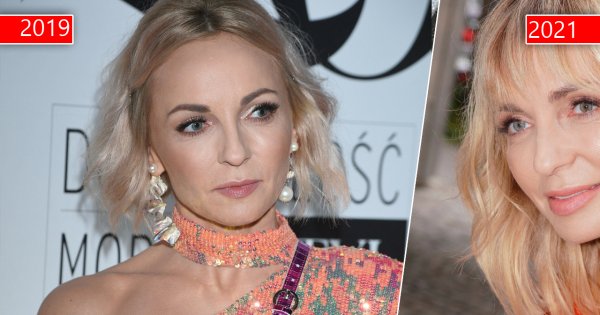 Anna Wyszkoni nie do poznania! Internauci atakują nowy wygląd artystki: "Totalny plastik. Atak klonów"