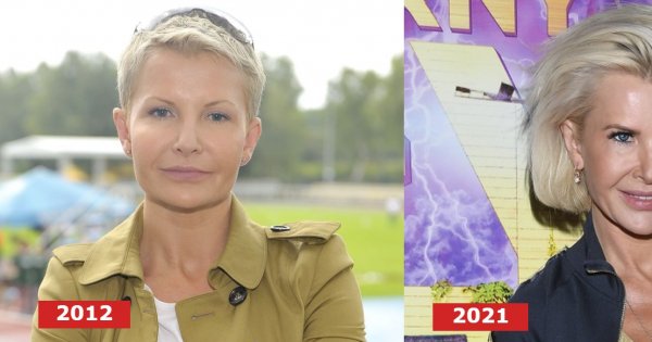 Joanna Racewicz i jej nowa twarz przyszły na premierę filmu "Czarny młyn". Przesadziła z zabiegami?