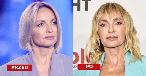 Anna Wyszkoni i jej nowa twarz na Flesz Fashion Night. "Czy ona przeszła przeszczep twarzy?" - pytają brutalnie internauci