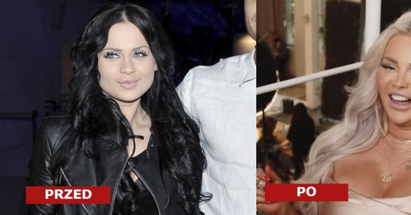 Ewelina Kubiak z "Warsaw Shore" ma nową twarz. Internauci przerażeni: Coś ty zrobiła? Ruszasz tylko oczami i ustami