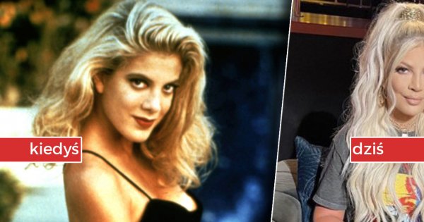 Fani zaniepokojeni nową twarzą Tori Spelling. "Przecież nie przypominasz już siebie... Dramat!" - piszą internauci