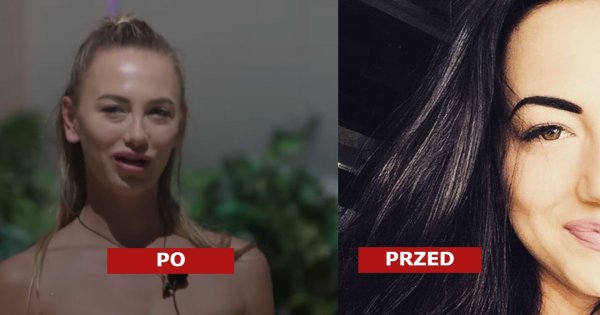 Ola Tomala z "Love Island" zoperowała nos, powiększyła usta i zrobiła brwi permanentne. Jak wyglądała przed operacjami w czarnych włosach?