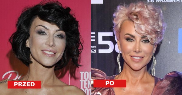 Paulla w pixie bob na festiwalu w Opolu. Ale fani patrzą na jej nową twarz. "Nos jej zaraz odpadnie" - piszą brzydko