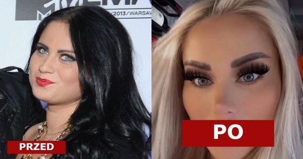 Ewelina Kubiak po raz kolejny powiększyła usta! Pokazała efekt! "Morda jak Predator" - piszą okrutnie internauci