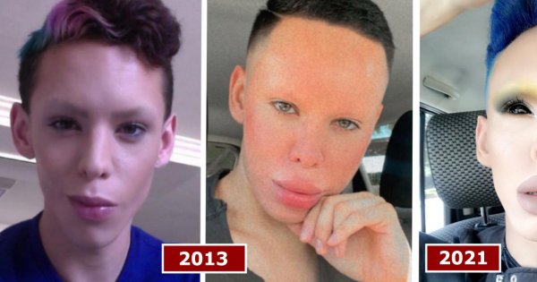 Vinny Ohh przeszedł ponad 110 operacji plastycznych, by wyglądać jak KOSMITA! Udało mu się?
