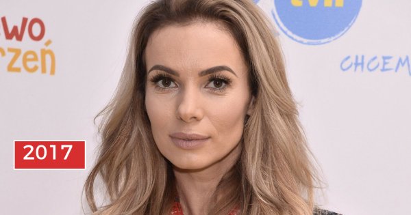 Izabela Janachowska nie do poznania... Ludzie pytają, co zrobiła z twarzą! Dlaczego tak piszą?