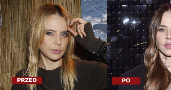 Maja Sablewska i jej "nowa twarz". Internauci ostro: "Jak Gnijąca panna młoda". Przesadziła z zabiegami?