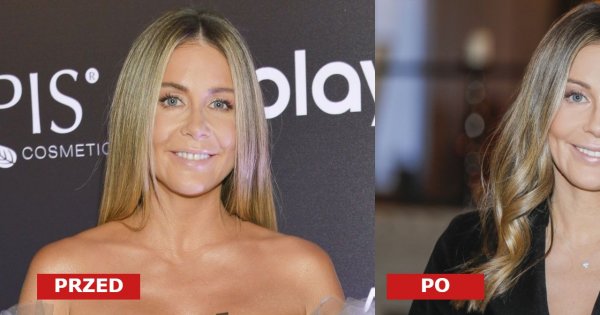 Małgorzata Rozenek na konferencji fundacji z "nową twarzą"! Internauci: "Źle to wyszło! Jak Grinch"