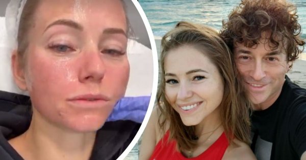 Agata Rubik opuchnięta po zabiegu: "Bez znieczulenia, dla lepszych efektów"