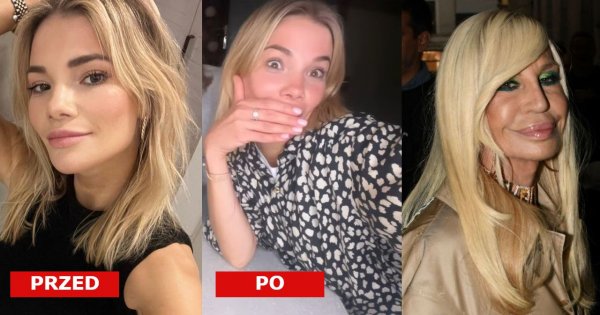 Maja Bohosiewicz powiększyła usta w Polsce! "Wyglądam jak Donatella Versace". Faktycznie?