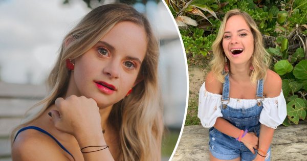 25-latka z zespołem Downa podbija świat mody! Sofía Jirau została modelką Victoria's Secret!