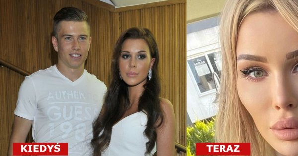 Aleksandra Kosecka, żona Jakuba, przeszła ogromną metamorfozę! Ma blond włosy i pokochała medycynę estetyczną. "Monstrum" - piszą