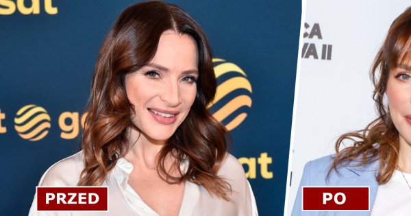 Anna Dereszowska obcięła grzywkę! Na ściance zachwyciła w nowej fryzurze i błękitnym garniturze!