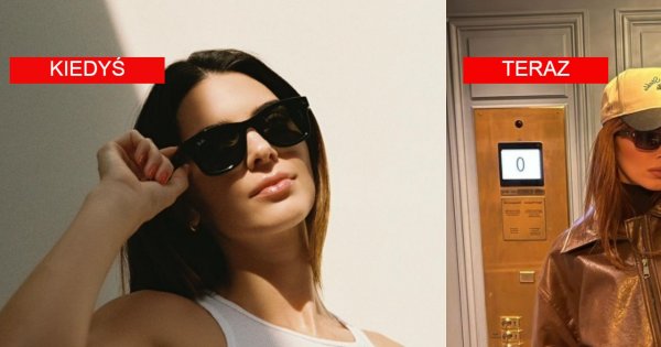 Kendall Jenner i jej powiększone usta promują nową kolekcję ubrań. Faktycznie majstrowała przy twarzy?