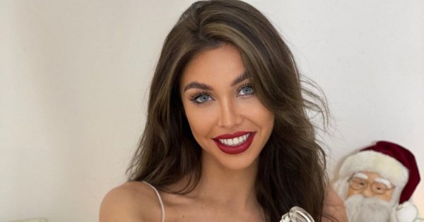 Magda Karwacka z "Love Island" przeszła kolejną operację plastyczną! Co sobie zrobiła?