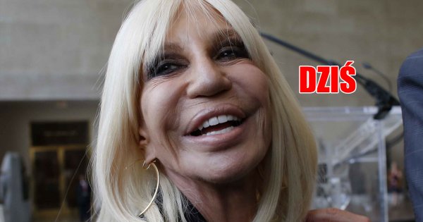 Donatella Versace 30 lat temu! Dziś jest nie do poznania... Dlaczego to sobie zrobiła?