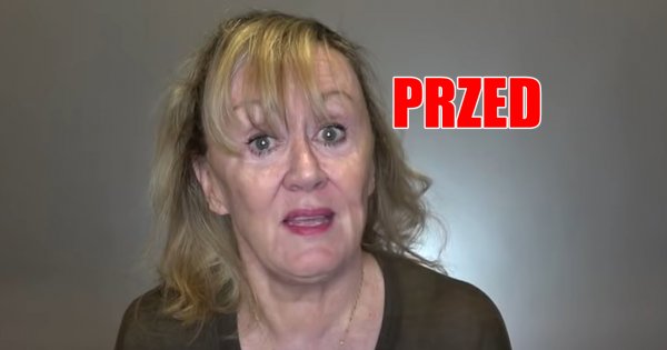 Ścięła cienkie włosy, bo miała dość związywania. Krótka fryzura totalnie ją odmieniła!