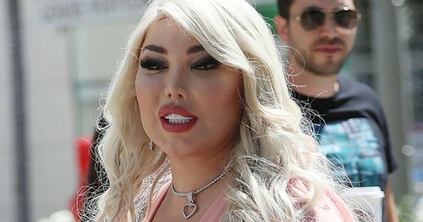 Po wydaniu MILIONA DOLARÓW, żeby najpierw upodobnić się do Kena, a następnie do Barbie, kończy z operacjami plastycznymi!