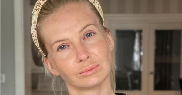 Edyta Pazura zadaje szyku w krótkiej sukience do połowy ud i gipsie na nodze... Z kulami również można wyglądać stylowo?