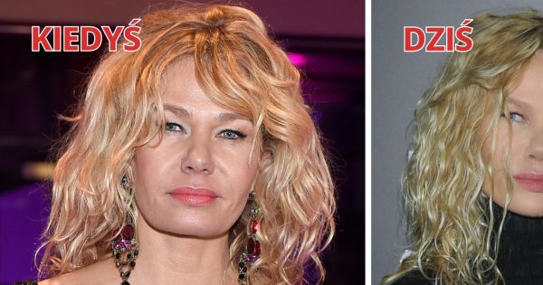 Katarzyna Wołejnio z "Żon Hollywood" wróciła! Co się stało z jej twarzą? "Kobieta-kot"?