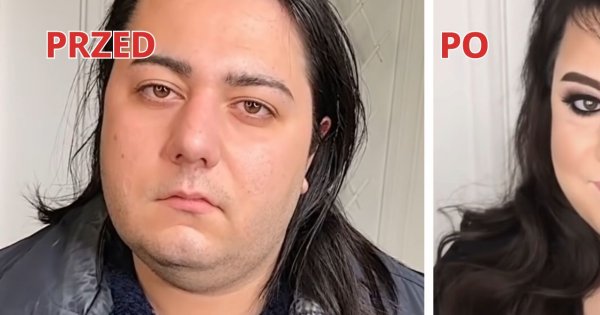 Szokująca metamorfoza kobiety mającej zaburzenia hormonalne. Makijaż dał efekt WOW!