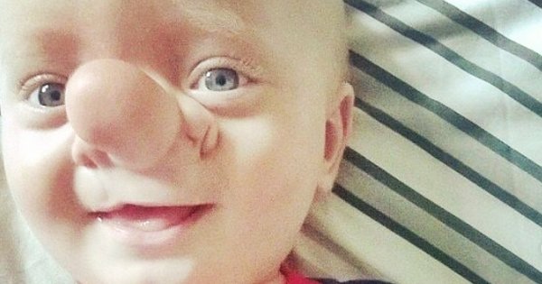 Śmiali się z noska jej synka. Nazywali go Pinokiem i dokuczali mu. Dziś jest nie do poznania!