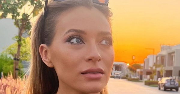 Marcelina Zawadzka ostrzega przed sztucznymi rzęsami! Przez ich doklejenie trafiła do szpitala!