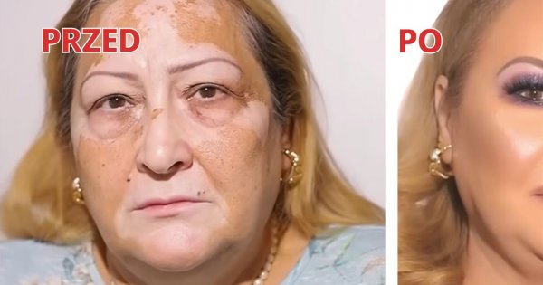 Niezwykła metamorfoza 60-latki z bielactwem. Fioletowe cienie i wyrównanie kolorytu pięknie podkreśliły jej urodę!